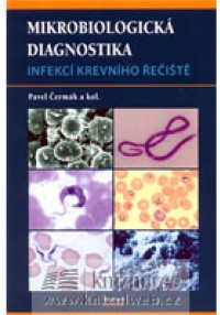 Mikrobiologická diagnostika, infekce krevn. řečišt