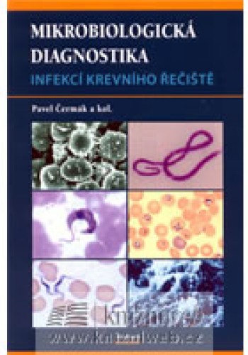 Mikrobiologická diagnostika, infekce krevn. řečišt
